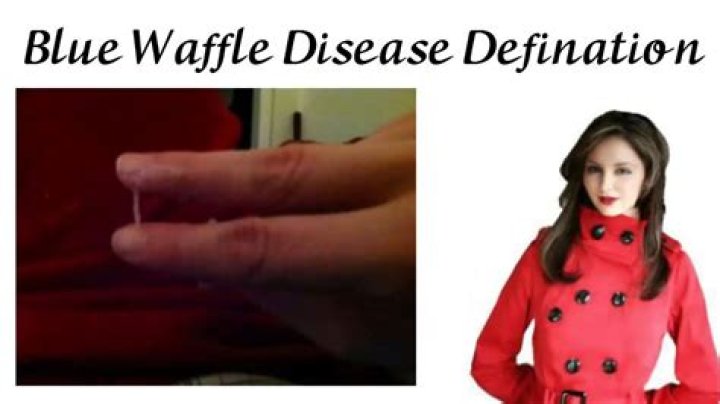Blue Waffle Definition YouTube