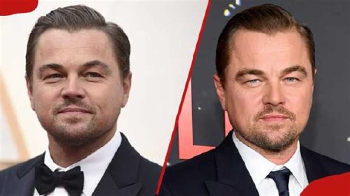 Famous Celebrities Born With Cleft Lips