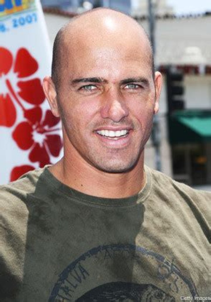 Going, Going, Gone! Outing Bald Celebrities Calum Best!