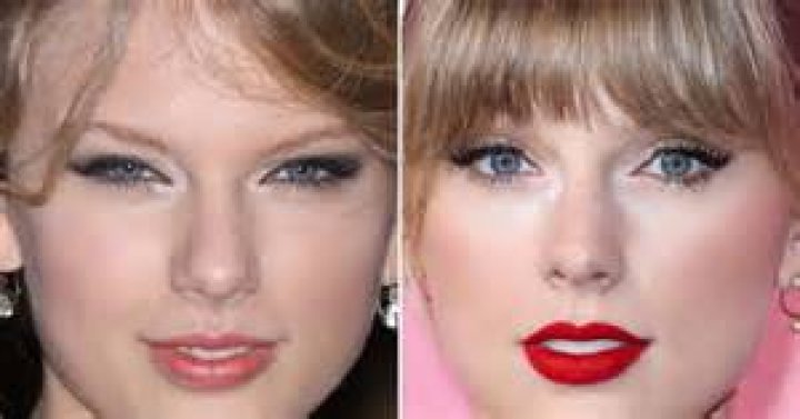 Taylor Swift Plastic Surgery Mystery SOLVED!