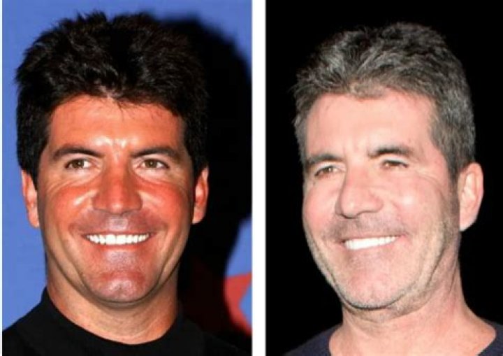 Understanding Simon Cowell's Illness: A Journey Through Challenges
