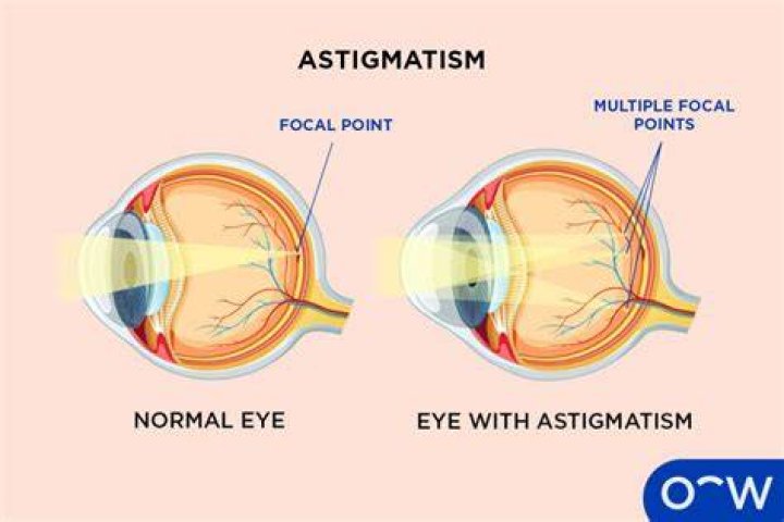 Why does astigmatism affect our night vision?
